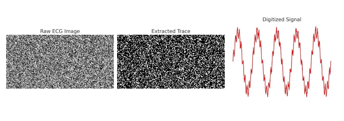 AI for AMR surveillance